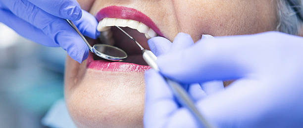 Best Urgent Dental Care for Toothaches in Georgetown, CO